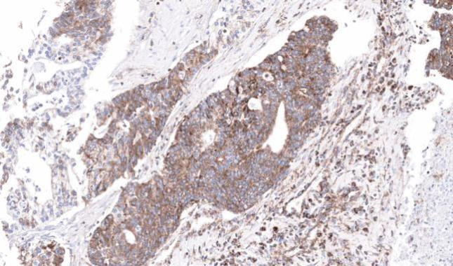 NDUFS4 Antibody in Immunohistochemistry (Paraffin) (IHC (P))