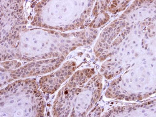 HS1BP3 Antibody in Immunohistochemistry (Paraffin) (IHC (P))