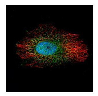 LIMK2 Antibody in Immunocytochemistry (ICC/IF)