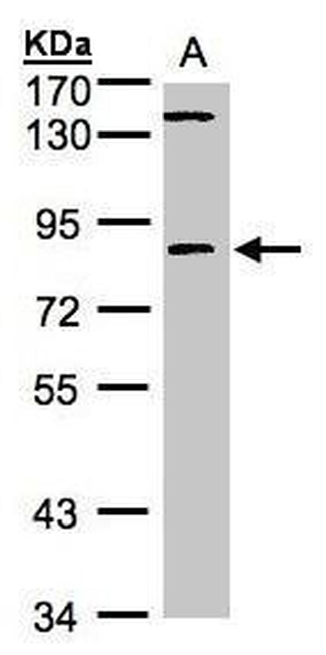 LIMK2 Antibody in Western Blot (WB)