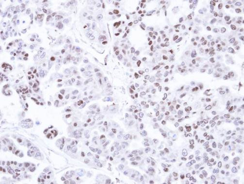 CAMK1D Antibody in Immunohistochemistry (Paraffin) (IHC (P))