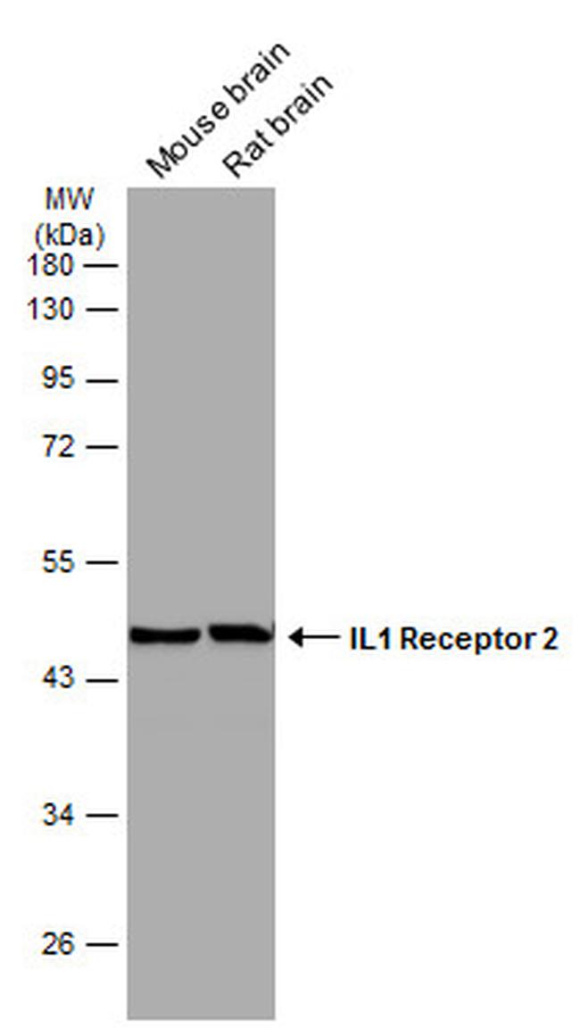 IL1R2 Antibody in Western Blot (WB)