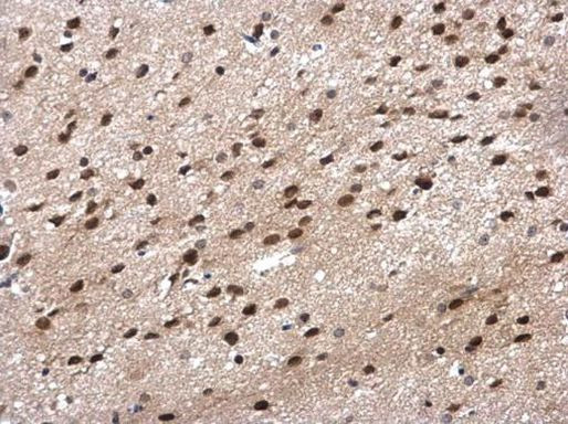 POLR2G Antibody in Immunohistochemistry (Paraffin) (IHC (P))