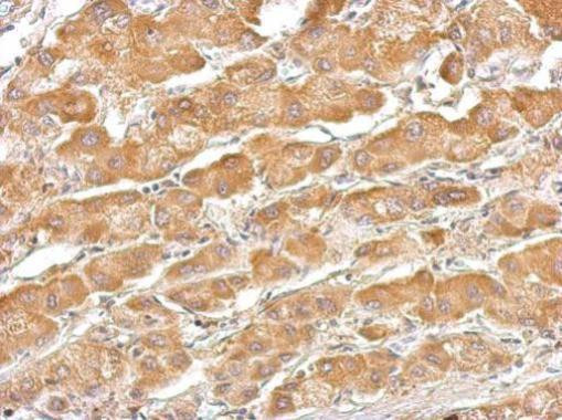 SERPINA7 Antibody in Immunohistochemistry (Paraffin) (IHC (P))