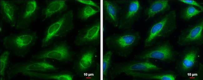 HMGCL Antibody in Immunocytochemistry (ICC/IF)