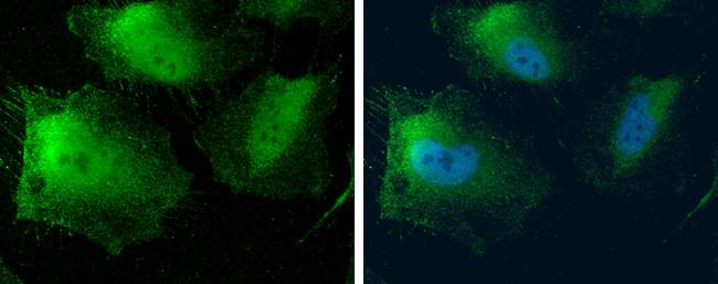 MTAP Antibody in Immunocytochemistry (ICC/IF)