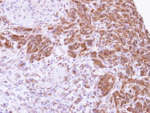 MTAP Antibody in Immunohistochemistry (Paraffin) (IHC (P))