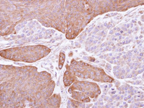 EPHX1 Antibody in Immunohistochemistry (Paraffin) (IHC (P))