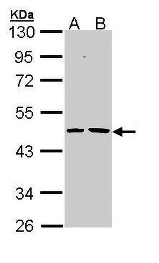 EPHX1 Antibody in Western Blot (WB)