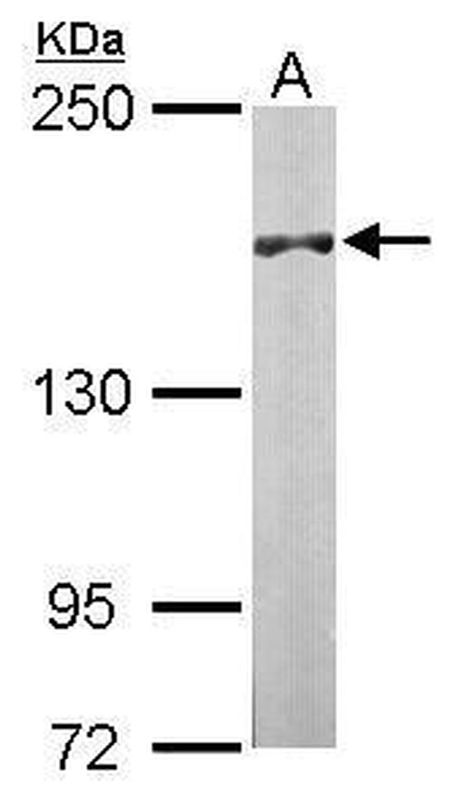 DIP2B Antibody in Western Blot (WB)