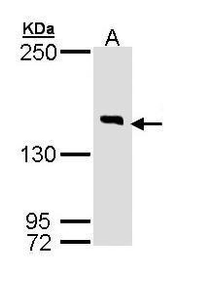 DIP2B Antibody in Western Blot (WB)
