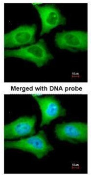 TCP-1 epsilon Antibody in Immunocytochemistry (ICC/IF)