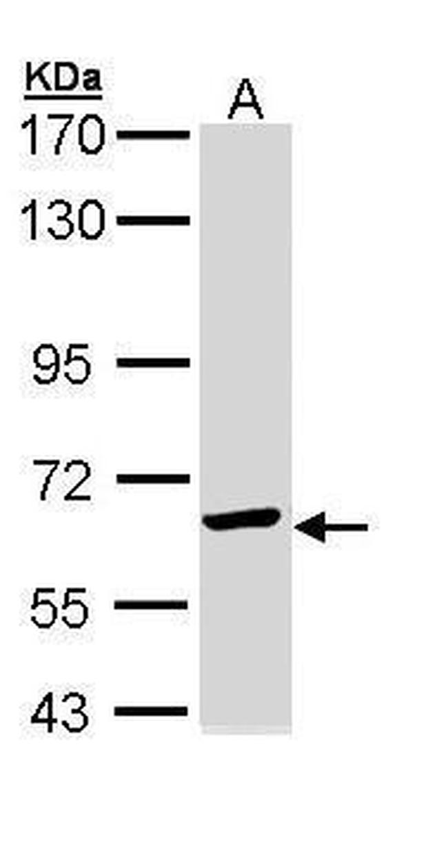 TCP-1 epsilon Antibody in Western Blot (WB)