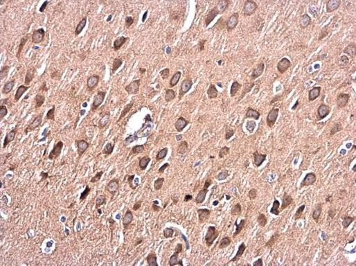 PKC alpha Antibody in Immunohistochemistry (Paraffin) (IHC (P))