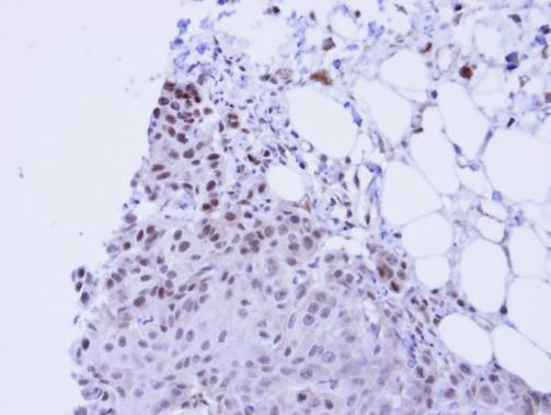 SSRP1 Antibody in Immunohistochemistry (Paraffin) (IHC (P))