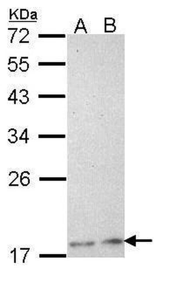 PLA2G12A Antibody in Western Blot (WB)