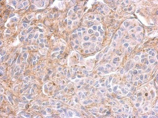 PPFIBP2 Antibody in Immunohistochemistry (Paraffin) (IHC (P))