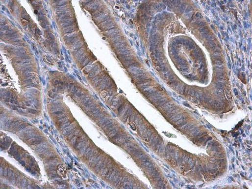 GBP3 Antibody in Immunohistochemistry (Paraffin) (IHC (P))