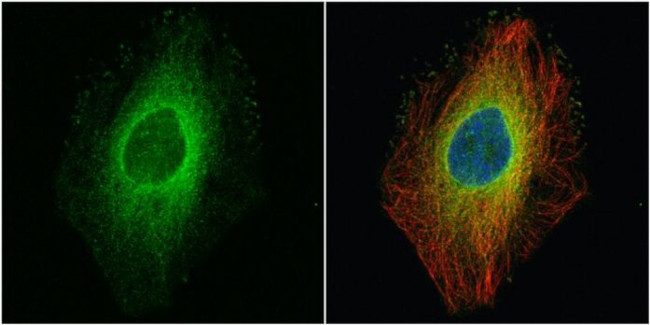 ROCK1 Antibody in Immunocytochemistry (ICC/IF)