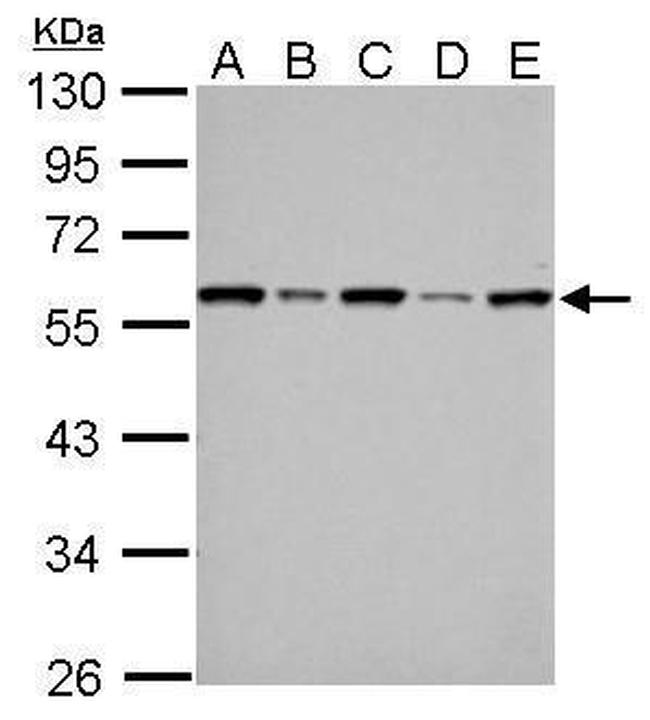 FKBP4 Antibody in Western Blot (WB)