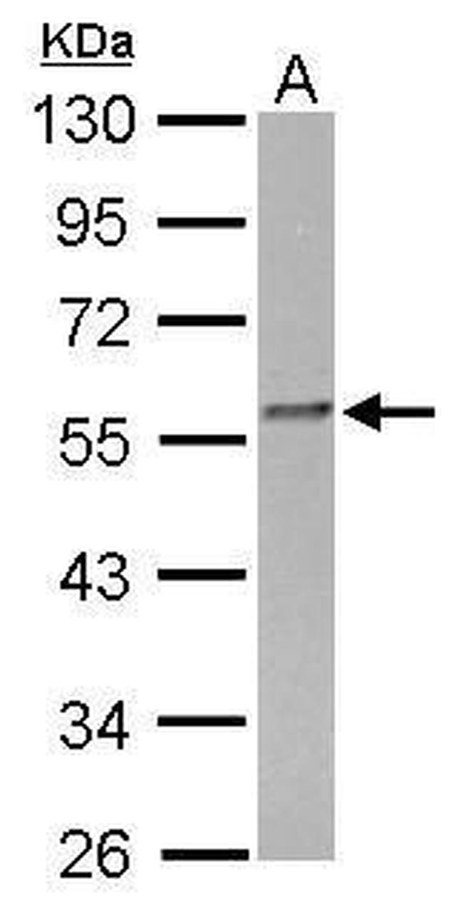 FKBP4 Antibody in Western Blot (WB)