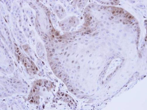 PSMB8 Antibody in Immunohistochemistry (Paraffin) (IHC (P))