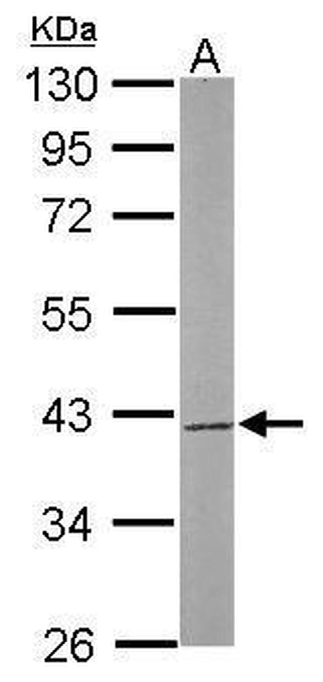 SAE1 Antibody in Western Blot (WB)