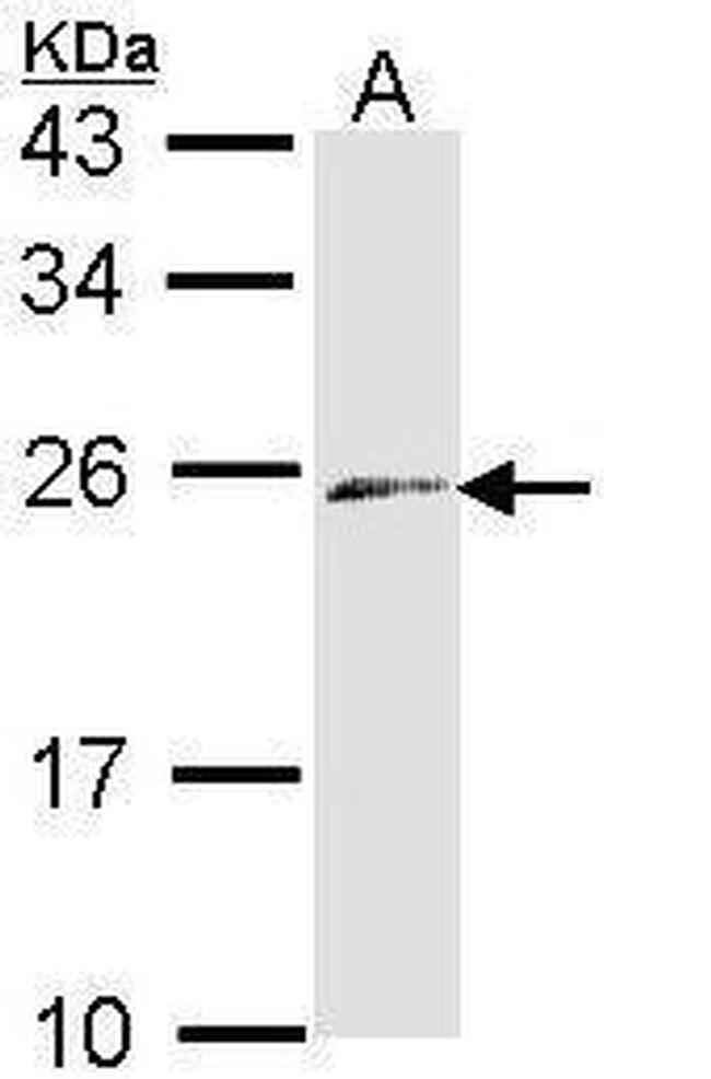 Endothelin 3 Antibody in Western Blot (WB)