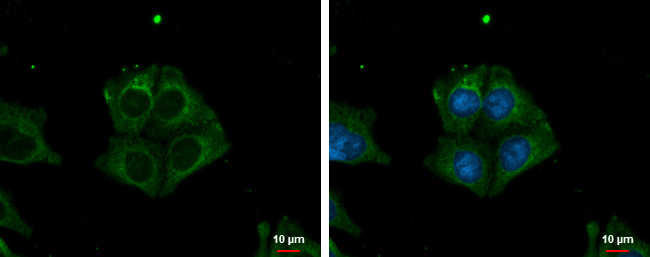 TRIM32 Antibody in Immunocytochemistry (ICC/IF)