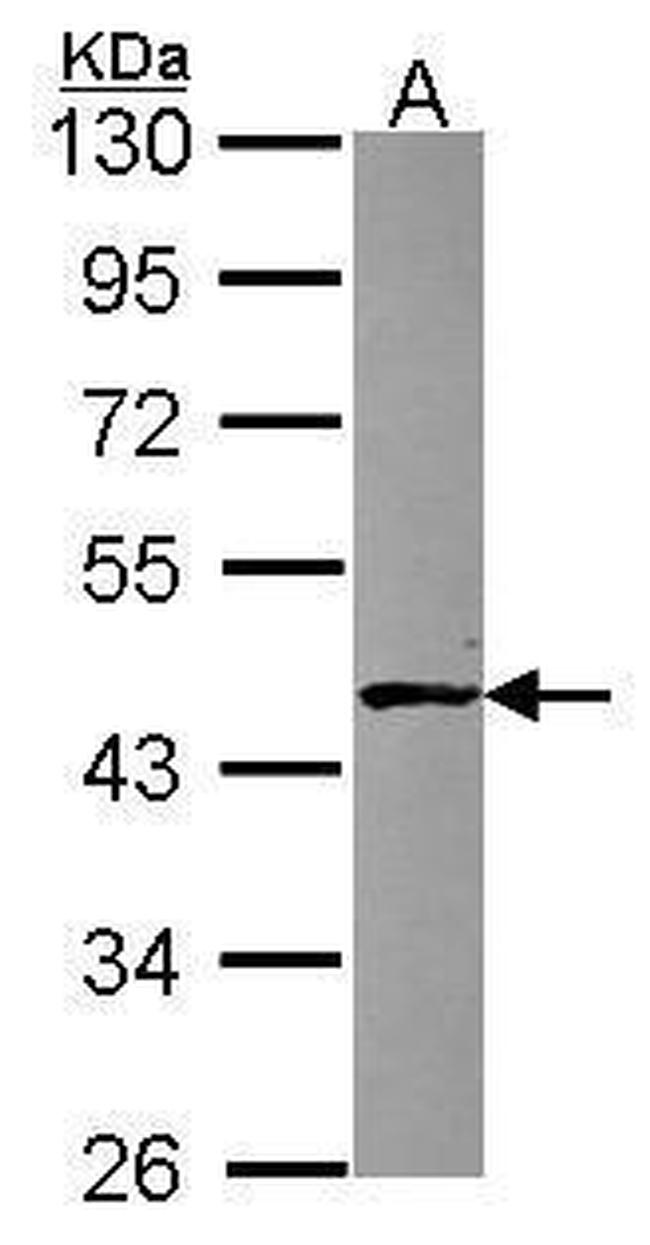 ABH1 Antibody in Western Blot (WB)