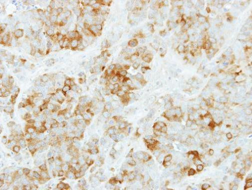 KYNU Antibody in Immunohistochemistry (Paraffin) (IHC (P))