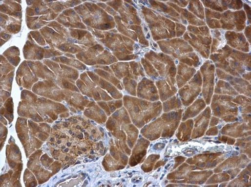 PDIR Antibody in Immunohistochemistry (Paraffin) (IHC (P))