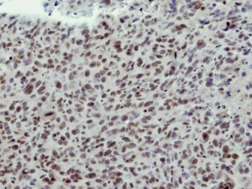 HEAB Antibody in Immunohistochemistry (Paraffin) (IHC (P))