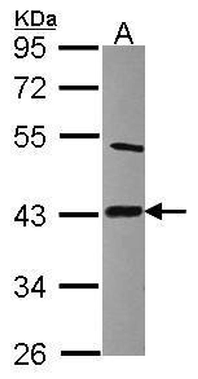 LIAS Antibody in Western Blot (WB)