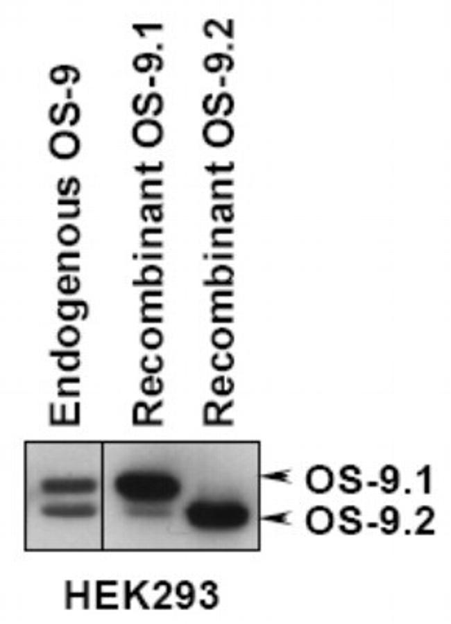 OS9 Antibody in Western Blot (WB)