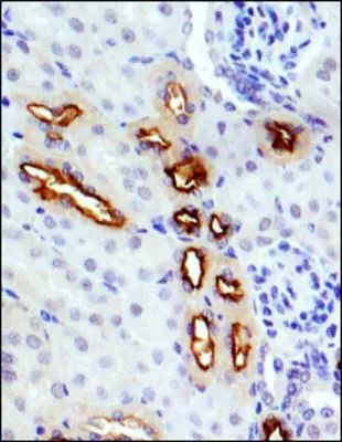 GLUT9 Antibody in Immunohistochemistry (Paraffin) (IHC (P))