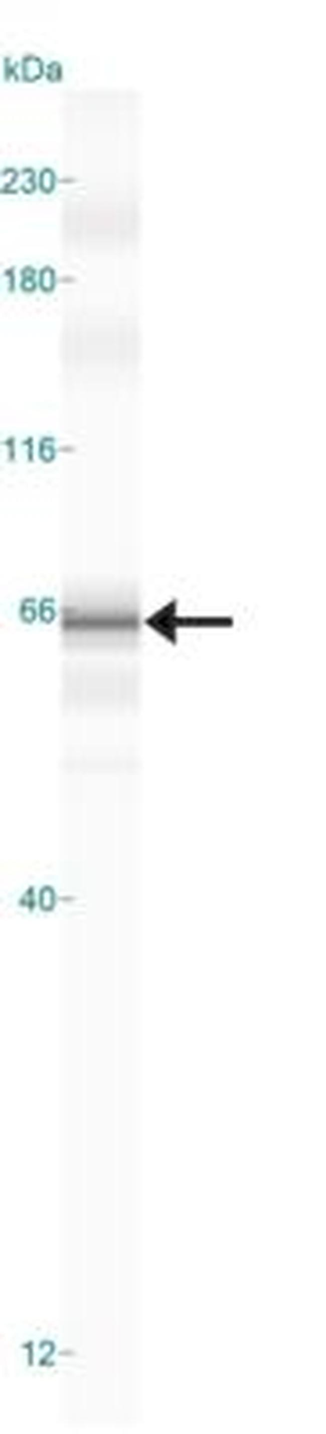 cIAP2 Antibody in Western Blot (WB)