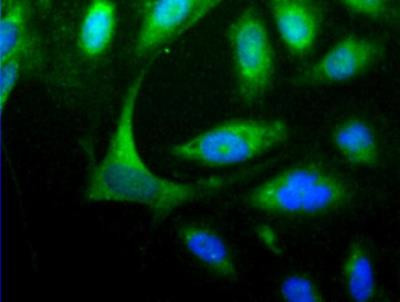 HOMER1 Antibody in Immunocytochemistry (ICC/IF)