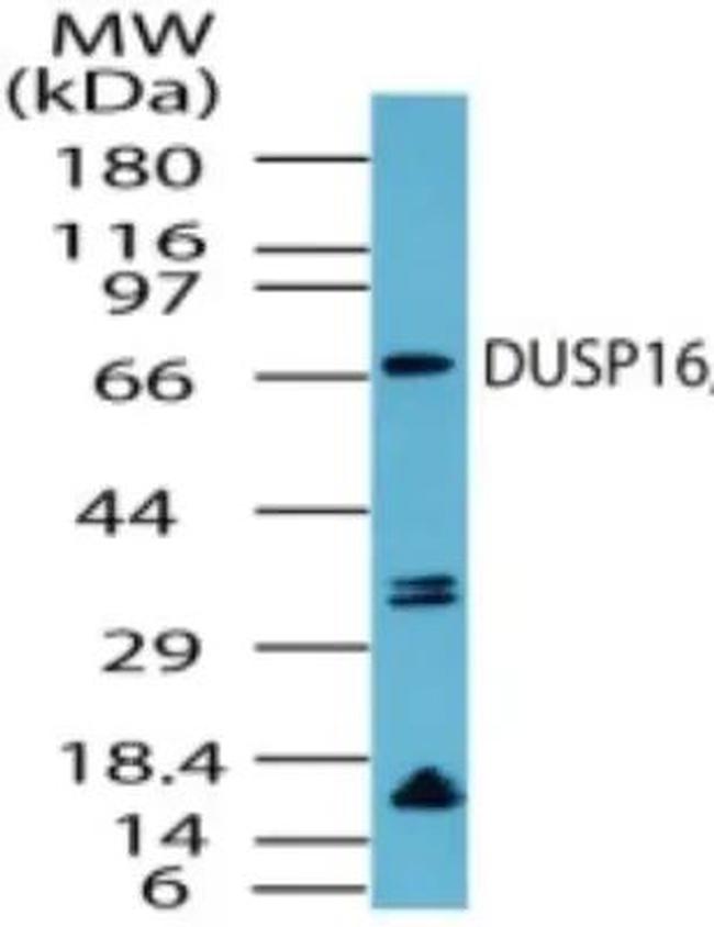 DUSP16 Antibody in Western Blot (WB)