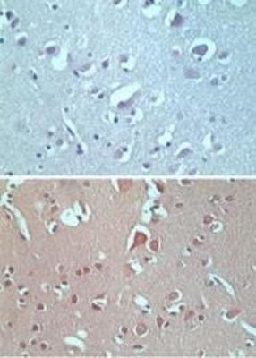 VANGL2 Antibody in Immunohistochemistry (Paraffin) (IHC (P))