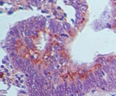 GBP1 Antibody in Immunohistochemistry (Paraffin) (IHC (P))