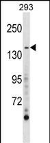 AEBP1 Antibody in Western Blot (WB)