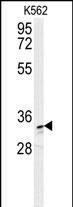 AKR1C3 Antibody in Western Blot (WB)