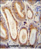 WFDC12 Antibody in Immunohistochemistry (Paraffin) (IHC (P))