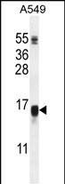 WFDC12 Antibody in Western Blot (WB)