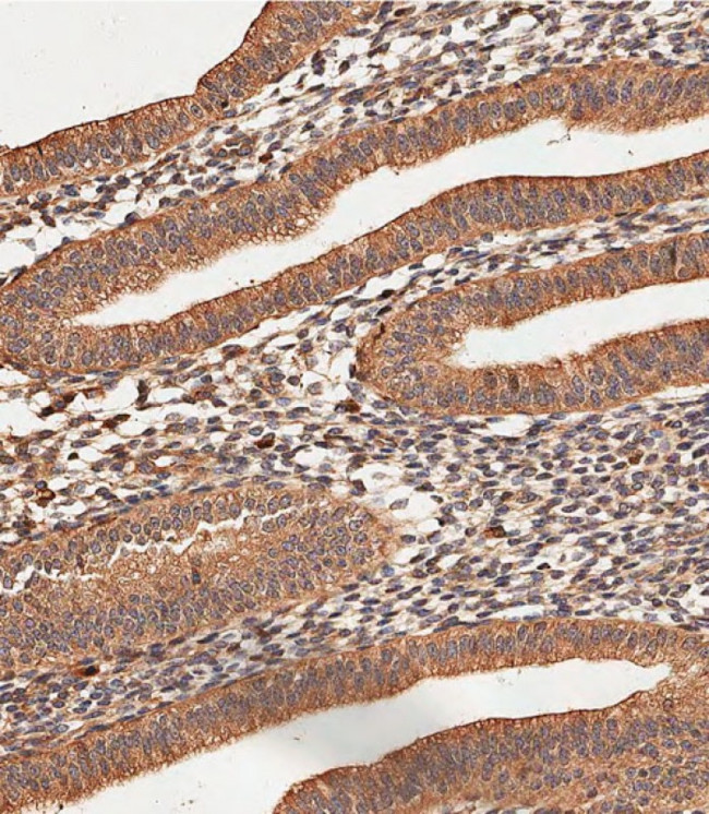 Collagen V Antibody in Immunohistochemistry (Paraffin) (IHC (P))