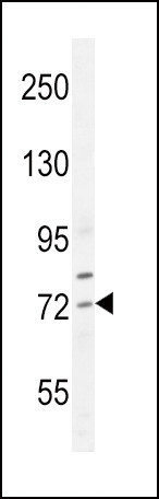SREBP2 Antibody in Western Blot (WB)