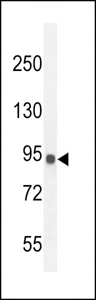 IL12RB2 Antibody in Western Blot (WB)