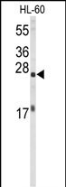 eIF4E Antibody in Western Blot (WB)