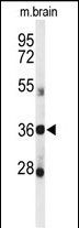 DDO Antibody in Western Blot (WB)